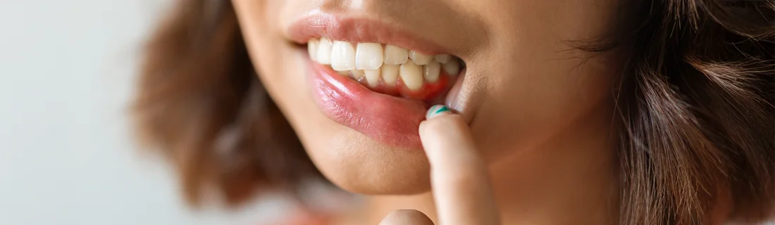 Periodontal Disease Treatment in Knoxville TN